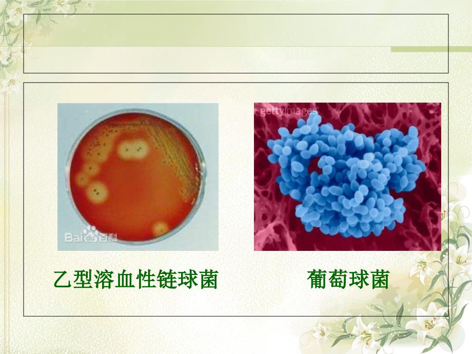 慢性扁桃体炎_第4页