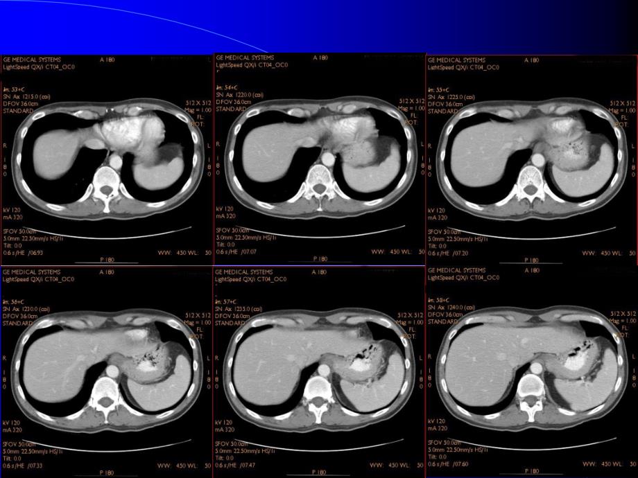 CT影像图谱PPT_第2页