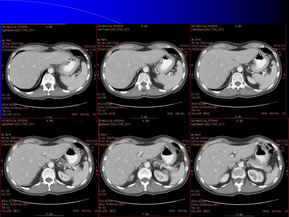 CT影像图谱PPT_第3页