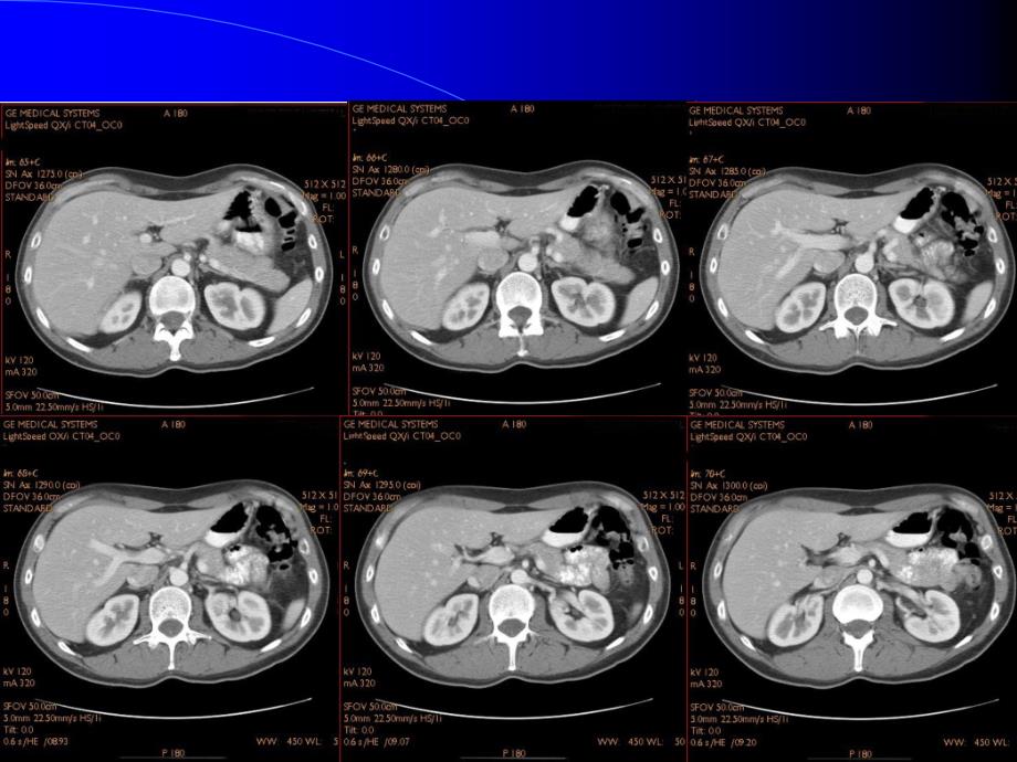 CT影像图谱PPT_第4页