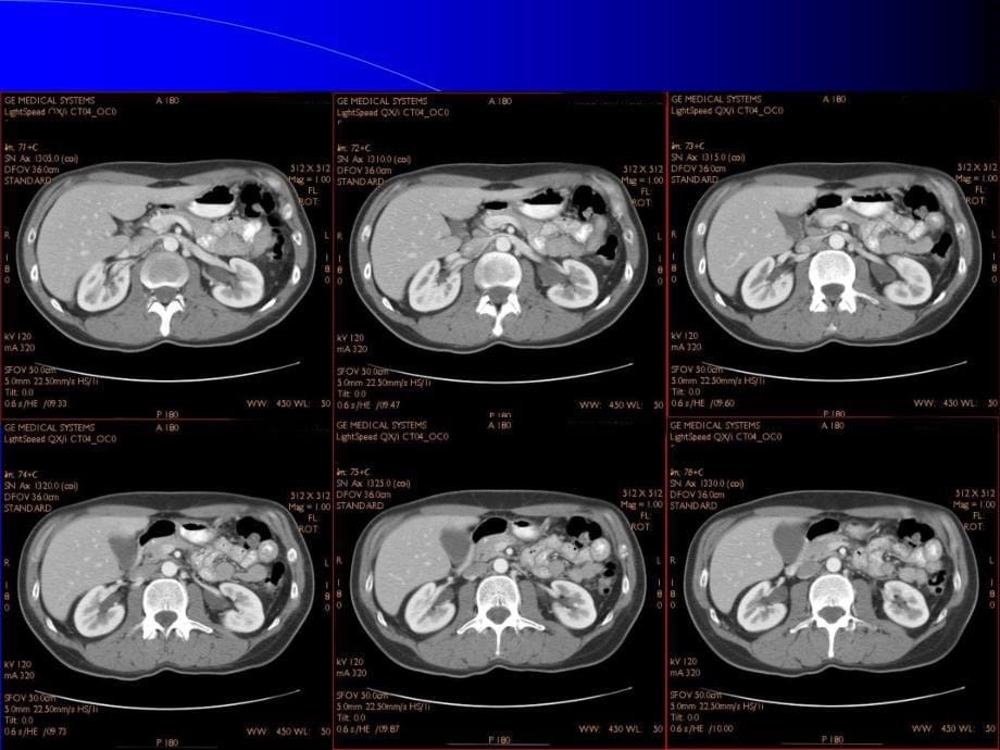 CT影像图谱PPT_第5页