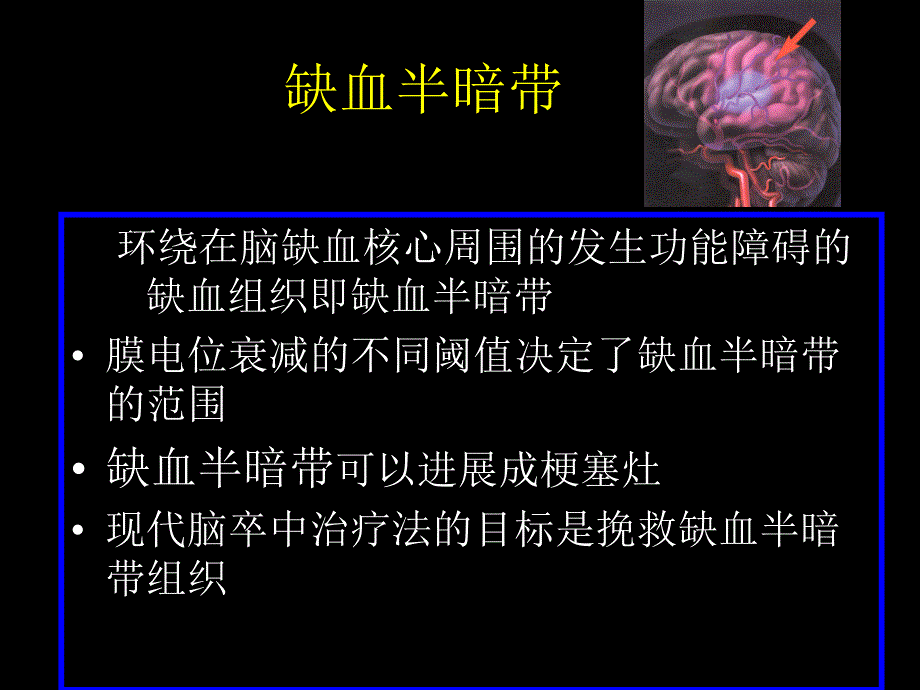 卒中的进展ppt课件_第1页