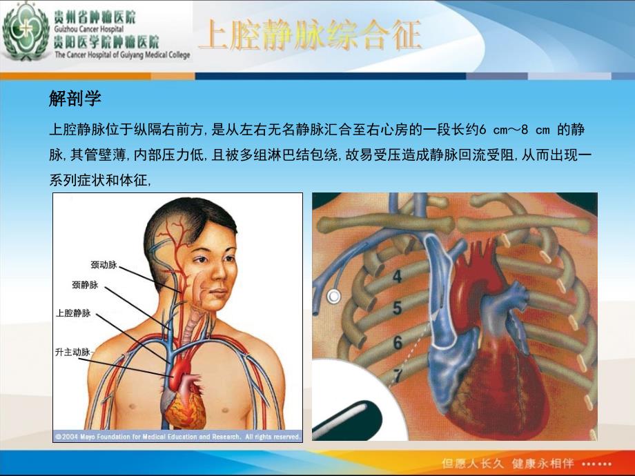 上腔静脉综合征修改后_第4页