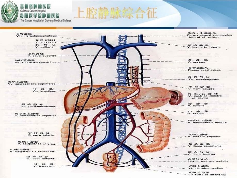 上腔静脉综合征修改后_第5页