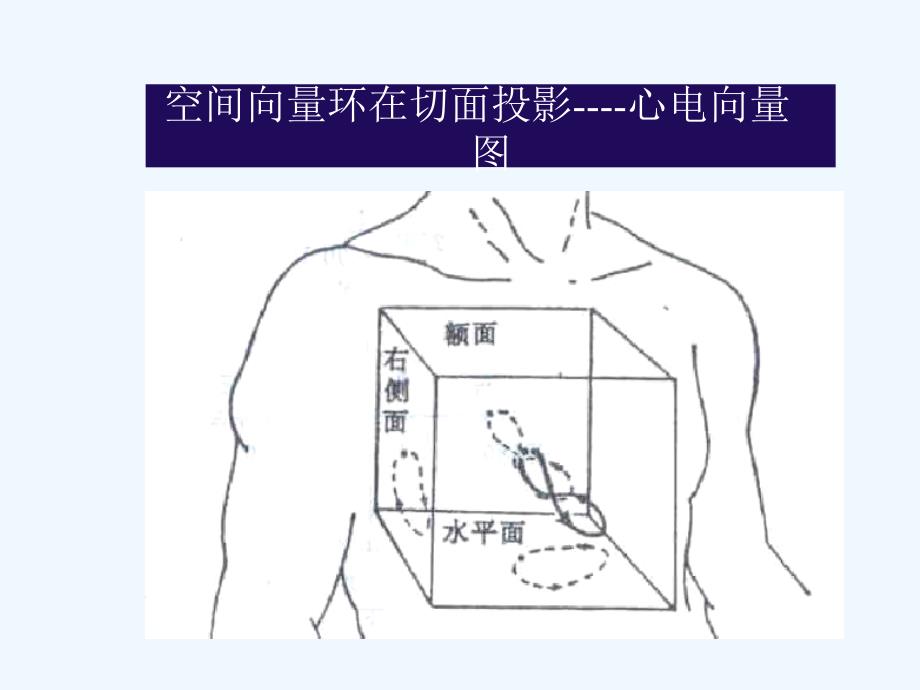 常见心电图诊断要点课件_第2页