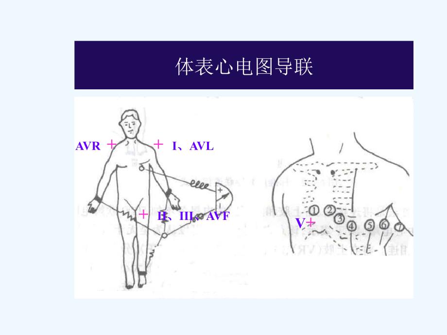 常见心电图诊断要点课件_第4页