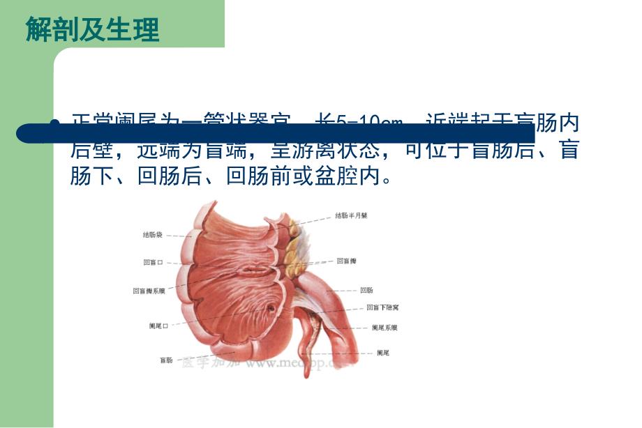 急性阑尾炎影像诊断学.ppt_第4页