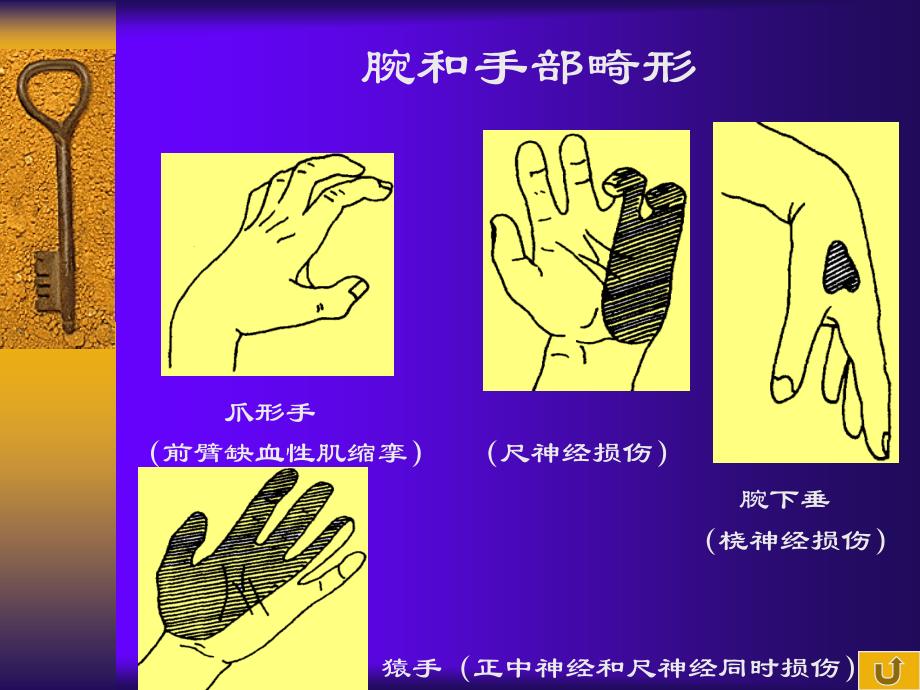 宝典]按摩学基础第三章腕部检查课件_第4页