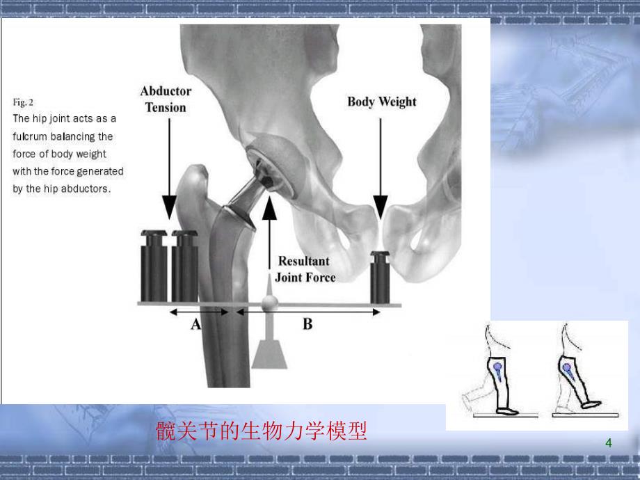 正常髋关节股骨偏心距的影像学研究ppt课件_第4页