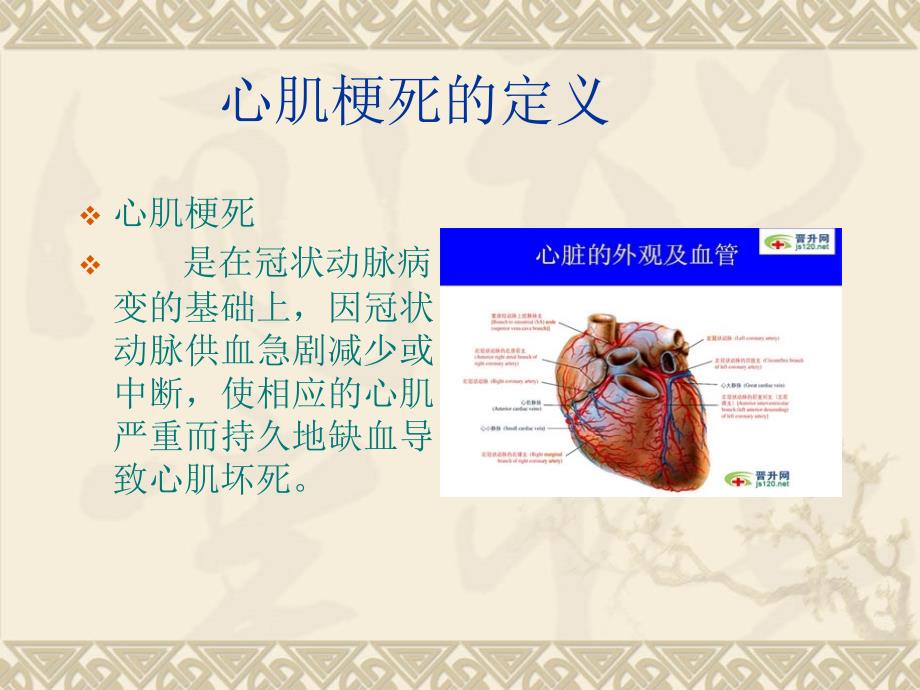 心肌梗死患者的护理.ppt_第3页