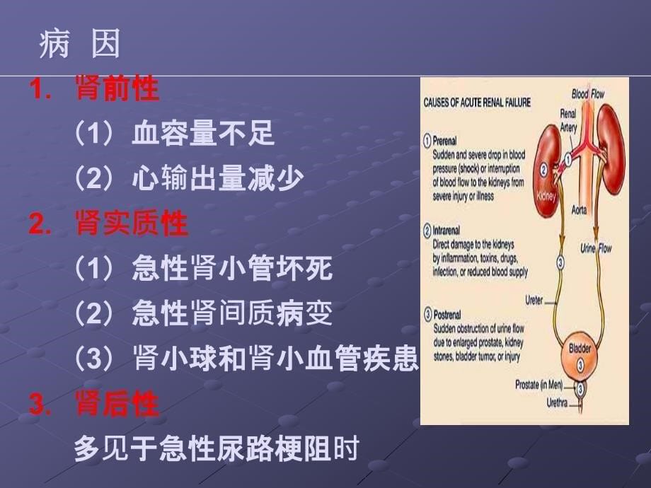 急性肾衰竭护理ppt课件.ppt_第5页