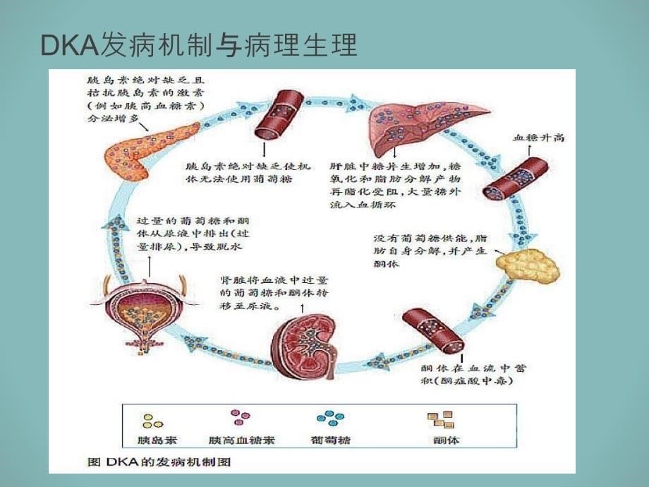 小儿糖尿病酮症酸中毒_第5页