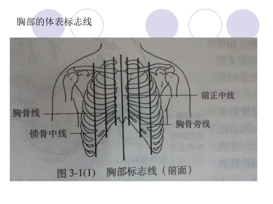 肋骨骨折_第5页