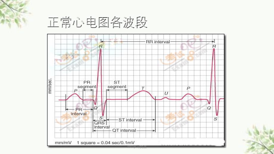 常见病心电图表现课件_第2页