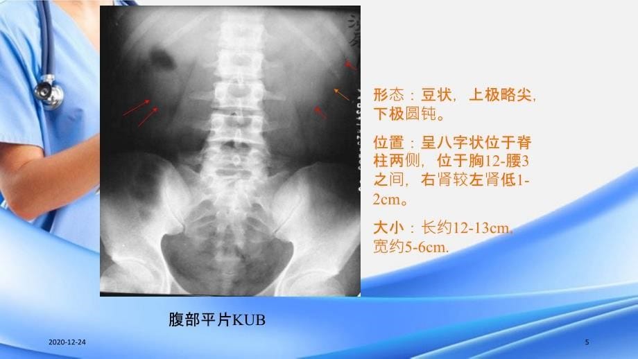 泌尿系统影像学表现精选干货_第5页