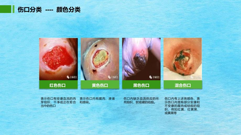 伤口护理学习心得ppt课件_第4页