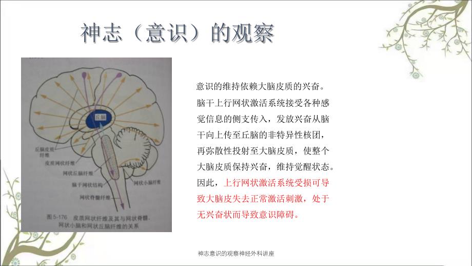 神志意识的观察神经外科讲座_第4页