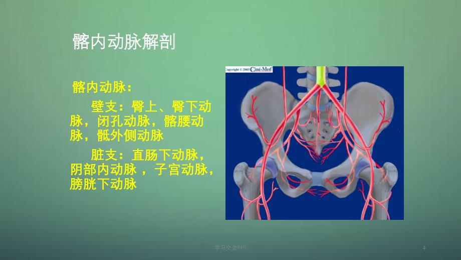 腹主髂动脉瘤腔内治疗ppt课件_第4页