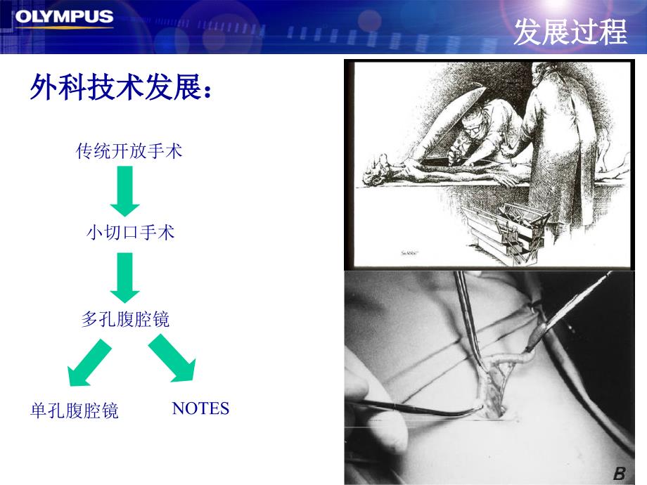 外科新技术奥林巴斯_第3页