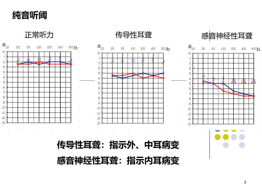 医学课件常见耳源性眩晕的诊断与治疗_第2页