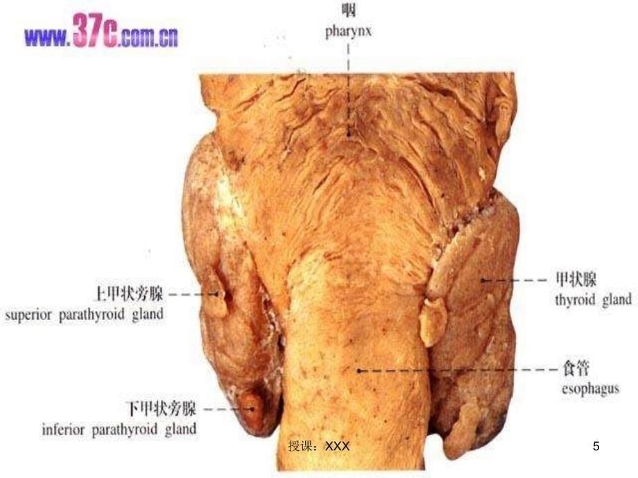 甲状旁腺亢进功能亢进护理PPT课件_第5页