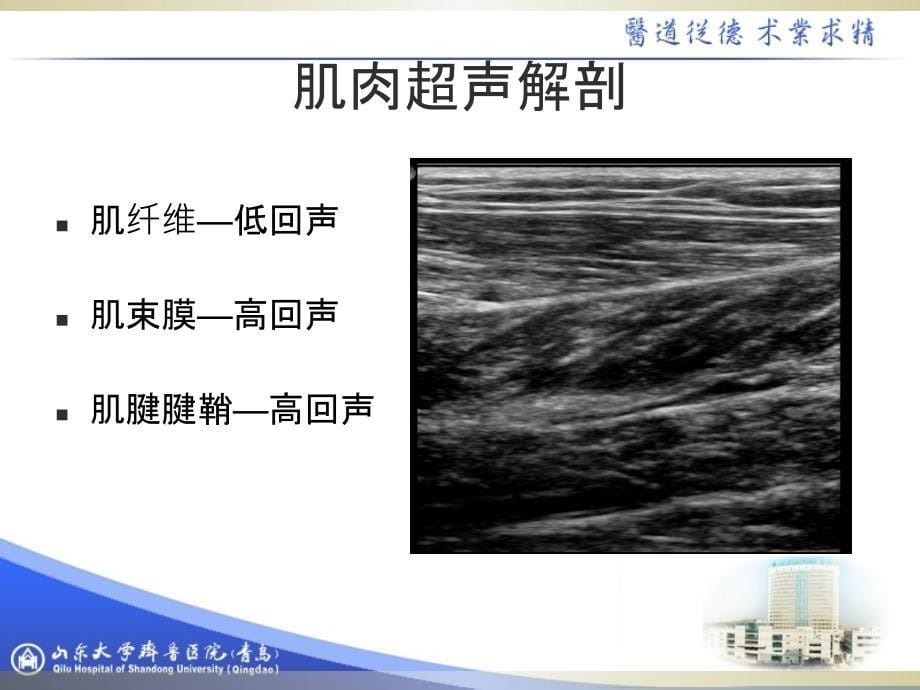 肌骨超声的临床应用1_第5页