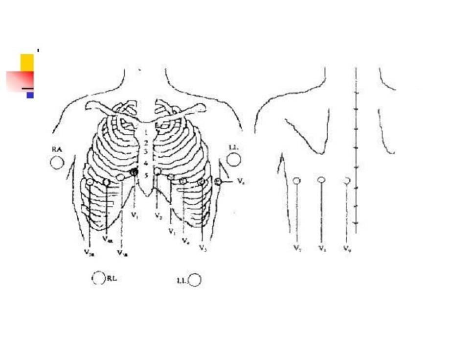 图文心电图机操作图解.ppt10_第5页