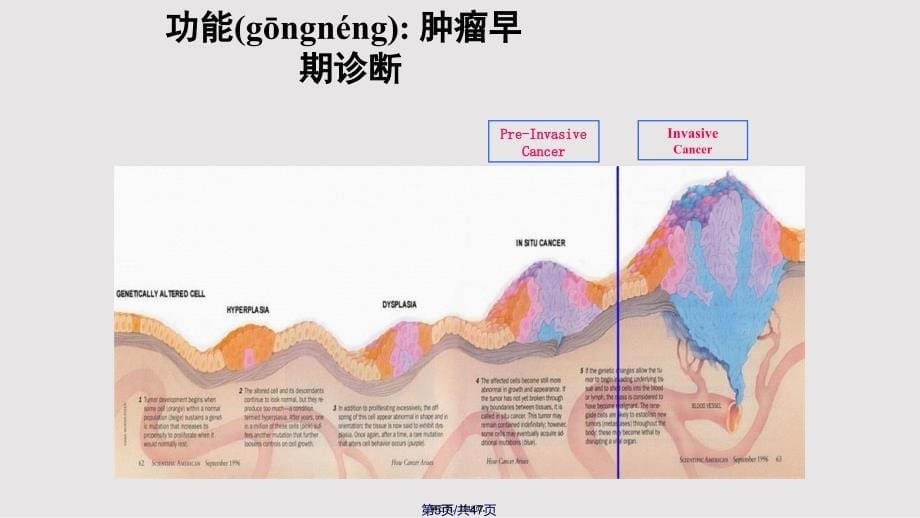 DNA倍体分析在临床病理中的应用宫颈印片实用教案_第5页