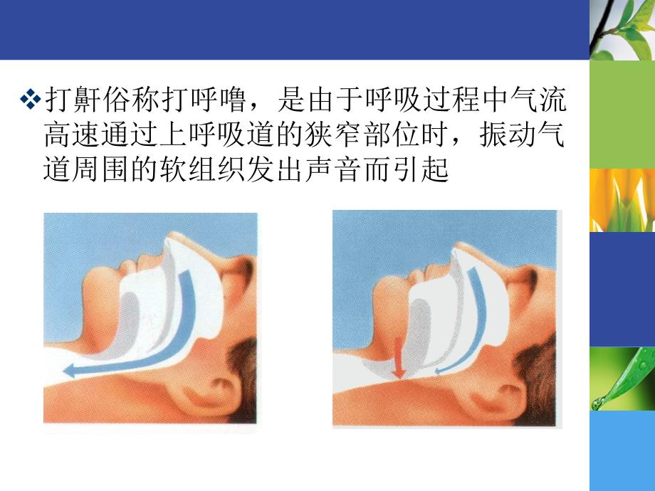 打鼾和和呼吸暂停课件_第3页