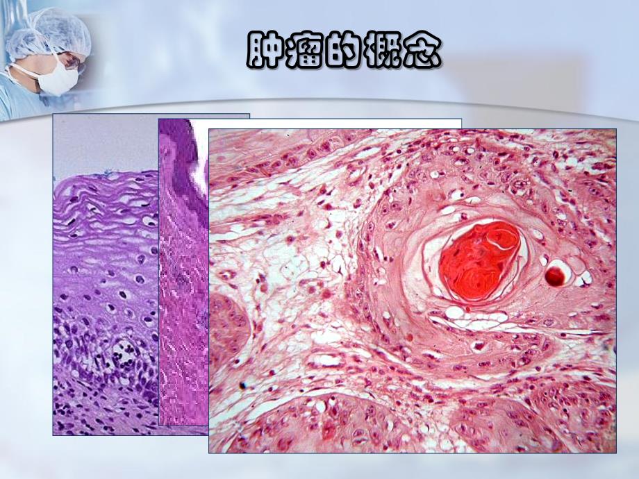 《病理学肿瘤》PPT课件_第3页