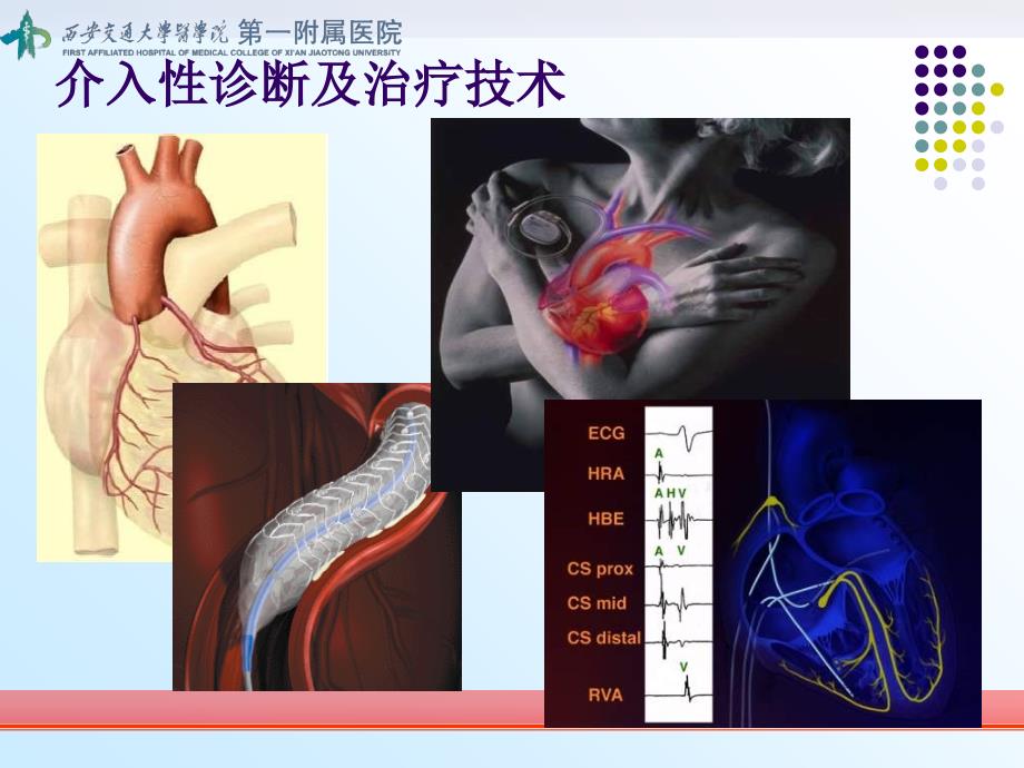 介入治疗前是否需要常规评估精神心理问题课堂PPT_第3页