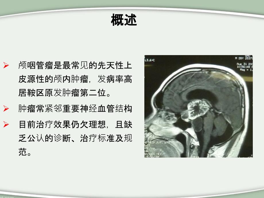 颅咽管瘤围手术期水电解质紊乱的处理原则分析_第2页