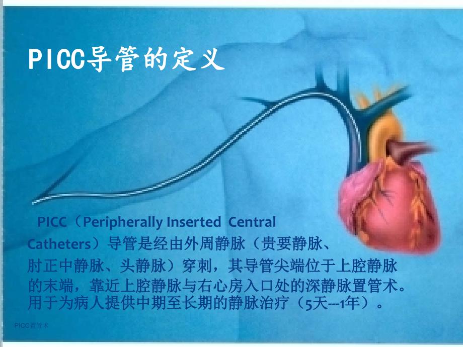 PICC置管术经典实用_第3页