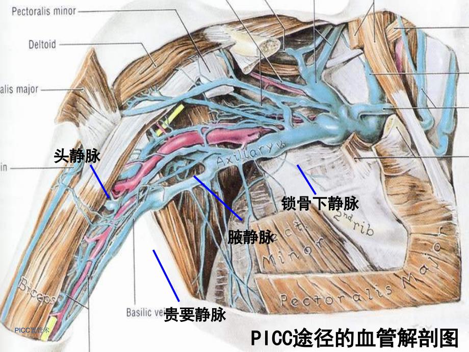 PICC置管术经典实用_第4页