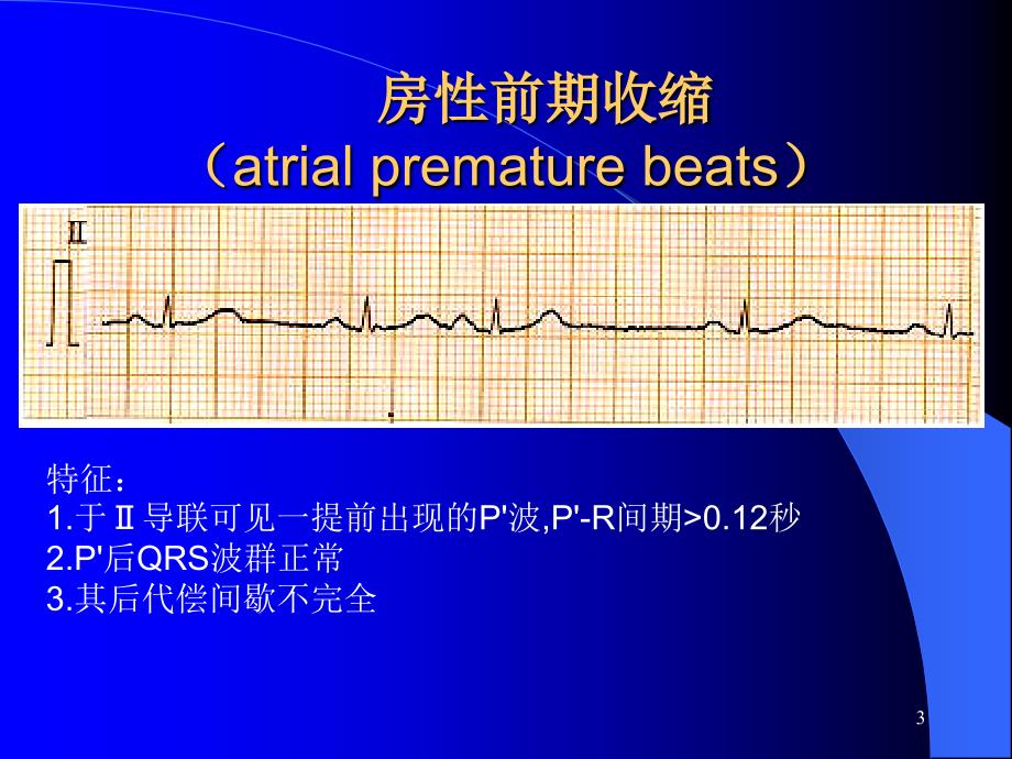 心律失常诊断及治疗 ppt课件_第3页