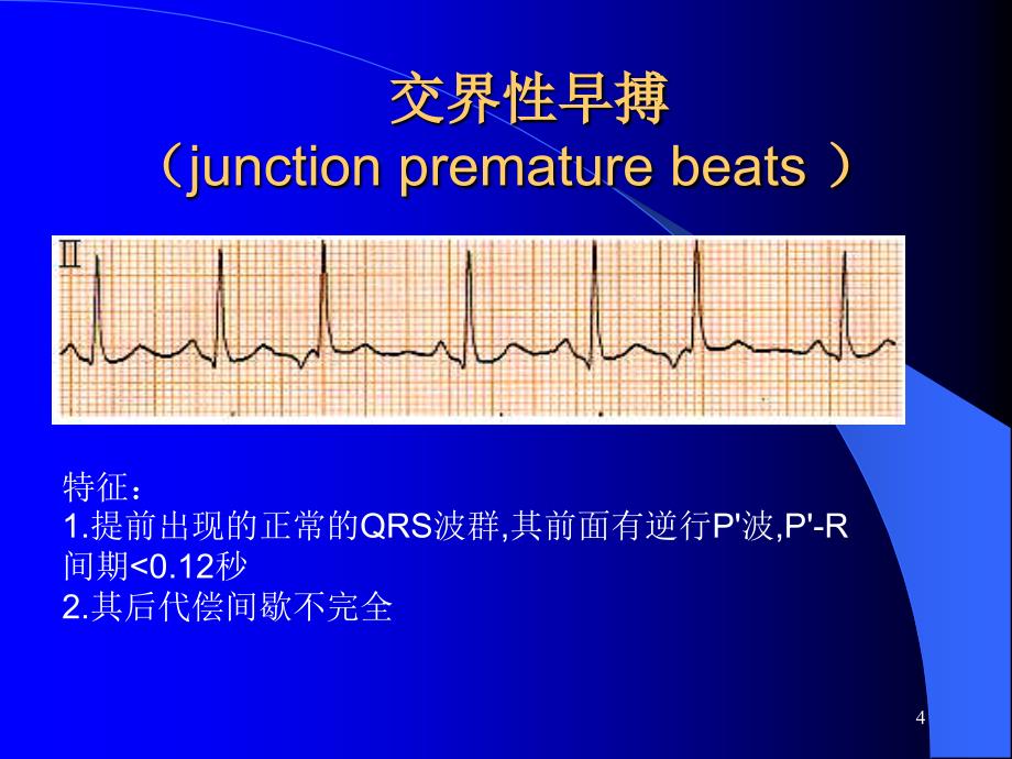 心律失常诊断及治疗 ppt课件_第4页