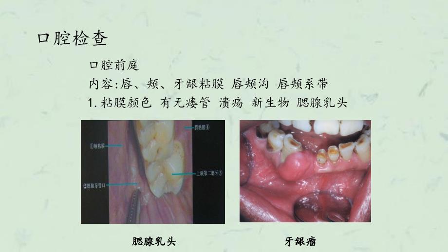 口腔颌面外科临床检查课件_第3页