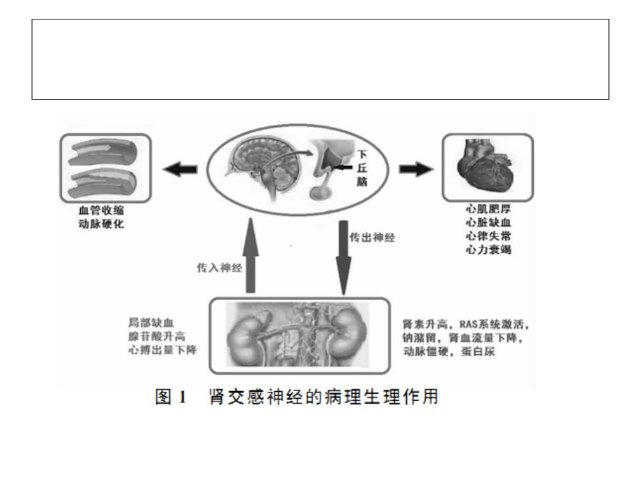 肾去神经支配减少心房颤动复发的可能机制_第3页