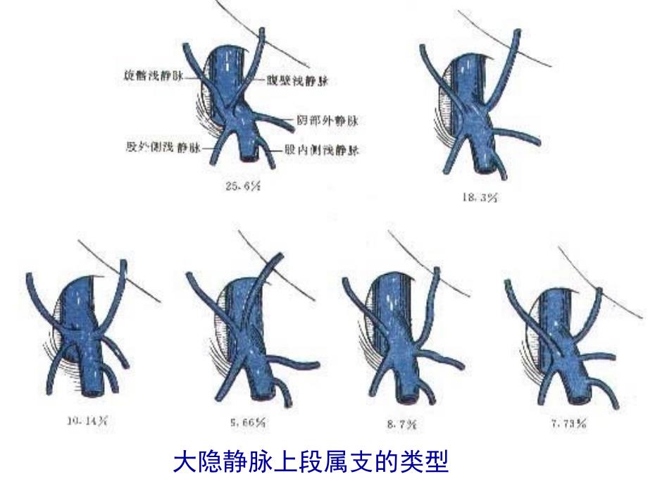 局部解剖：股前内侧区--小腿前外侧区_第4页