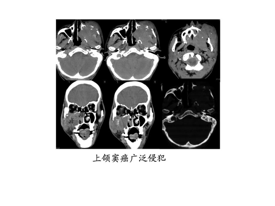 《临床医学影像检查》PPT课件_第1页