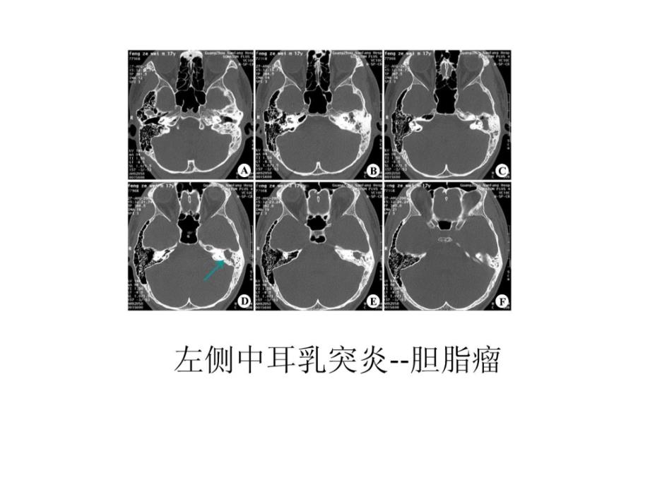 《临床医学影像检查》PPT课件_第2页