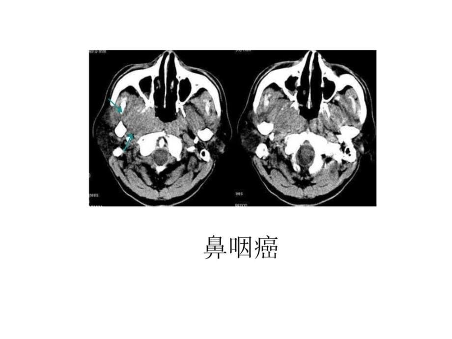 《临床医学影像检查》PPT课件_第5页