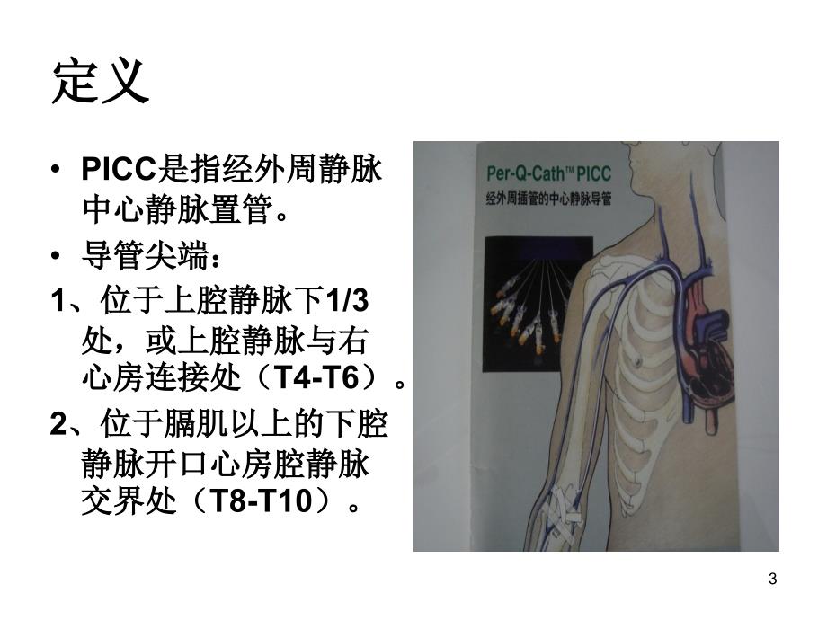 生儿PICC置管及护理参考PPT_第3页