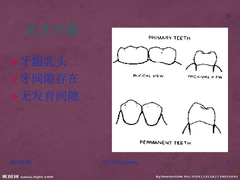 儿童口腔牙周粘膜组织疾患_第5页