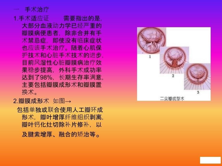 风湿性心脏病临床表现及护理精编ppt_第5页