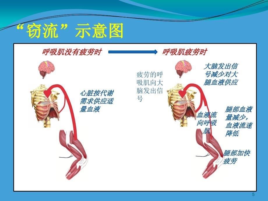 肺功能评估与训练的意义ppt课件_第5页