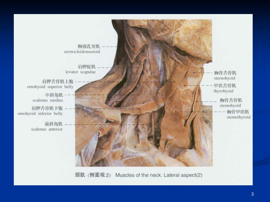 颈椎病的MRI诊断PPT课件_第3页