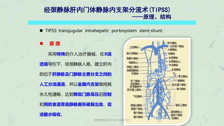 经颈静脉肝内门体分流术TIPS课件_第3页