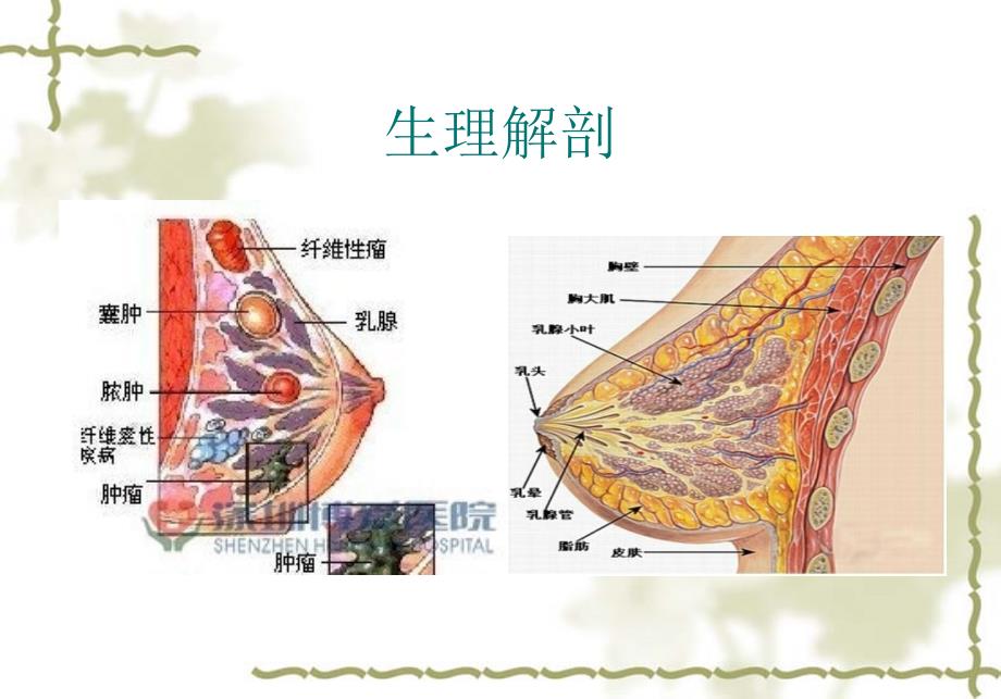 乳腺癌护理查房_第2页