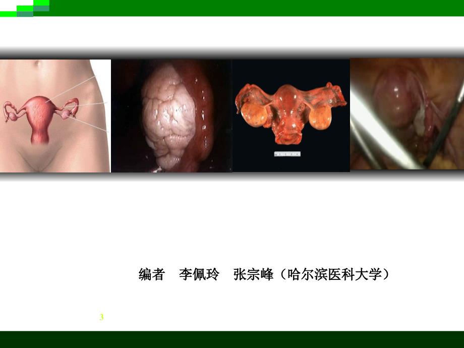 女性生殖系统解剖-妇产科学(本科)课件_第3页